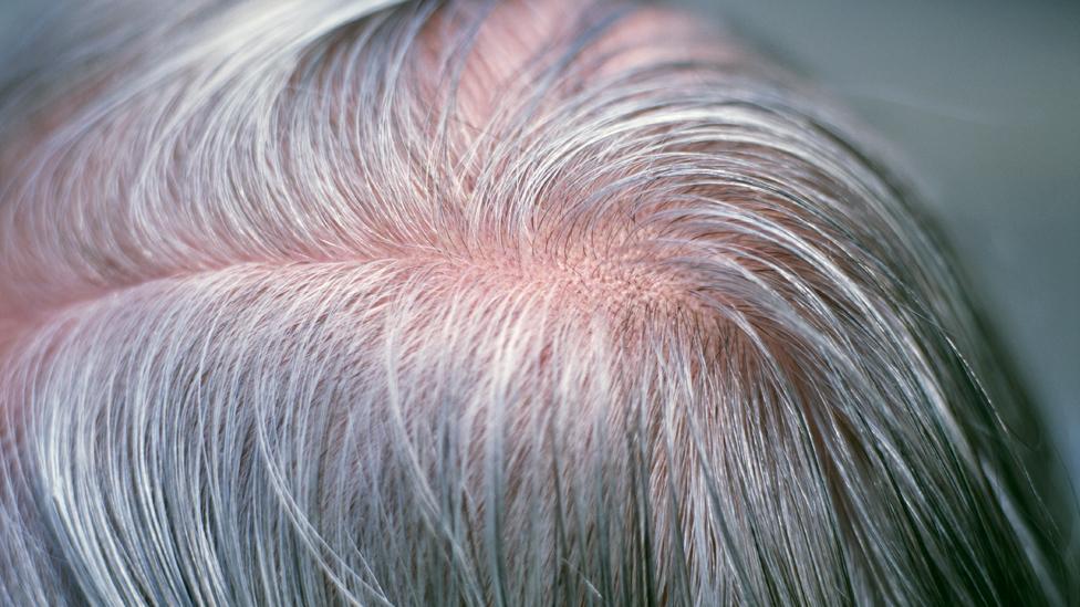 hair white