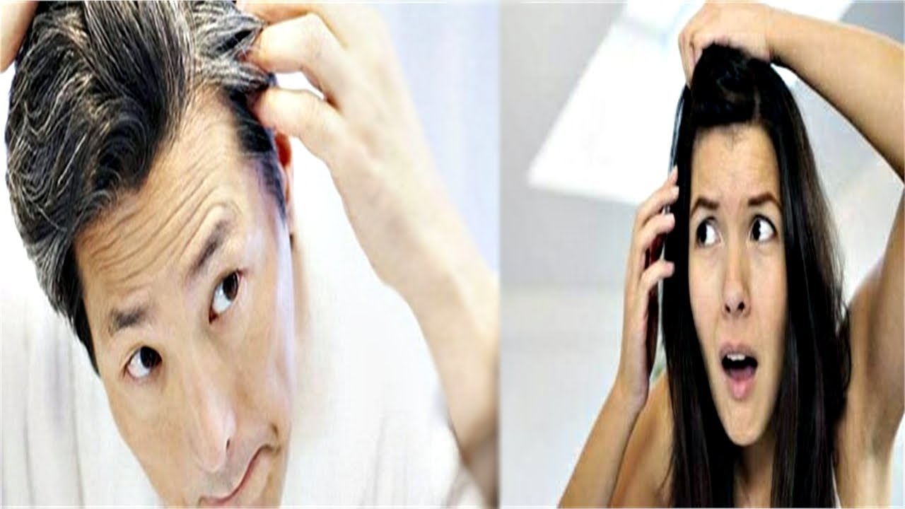 white hair