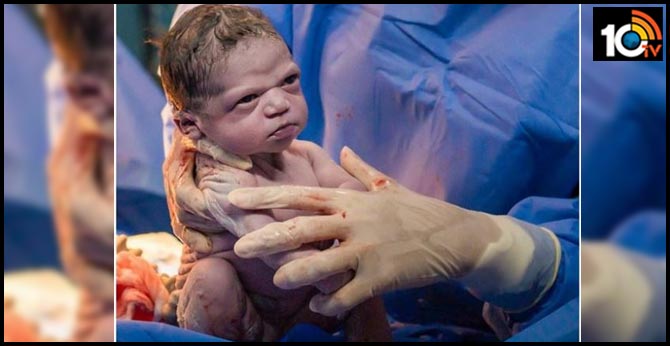 just born baby photo goes viral shows frowning doctor tries make cry