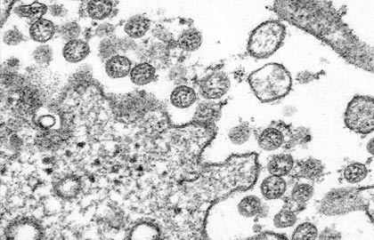 covid-19 photos up close with the deadly coronavirus
