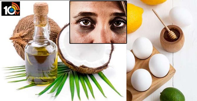https://10tv.in/life-style/how-to-get-rid-of-dark-circles-at-home-in-lockdown-time-58954.html