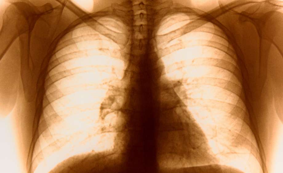 lungs