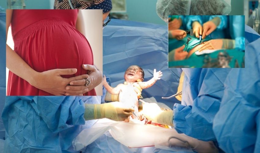https://10tv.in/latest/telangana-government-gives-midwifery-training-to-hospital-staff-for-normal-delivery-avoid-to-cesarean-operations-307270.html