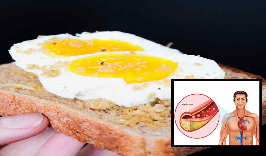 https://10tv.in/life-style/how-to-reduce-bad-cholesterol-in-the-body-356304.html