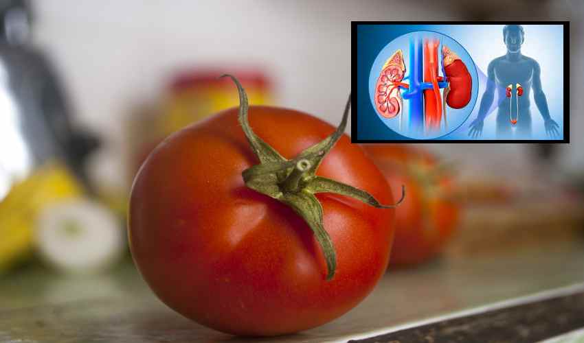 https://10tv.in/life-style/does-eating-tomatoes-cause-kidney-stones-347340.html