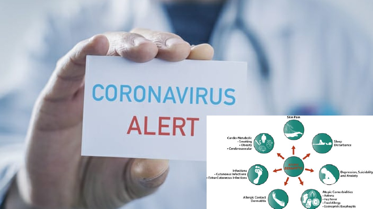 https://10tv.in/national/majority-of-covid-19-infected-students-in-delhi-hospitals-have-comorbidities-409506.html