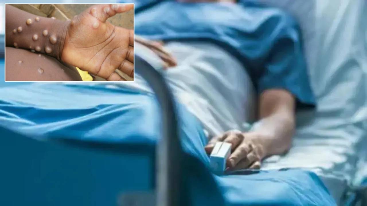 https://10tv.in/international/israel-reports-first-monkeypox-patient-more-cases-suspected-430813.html