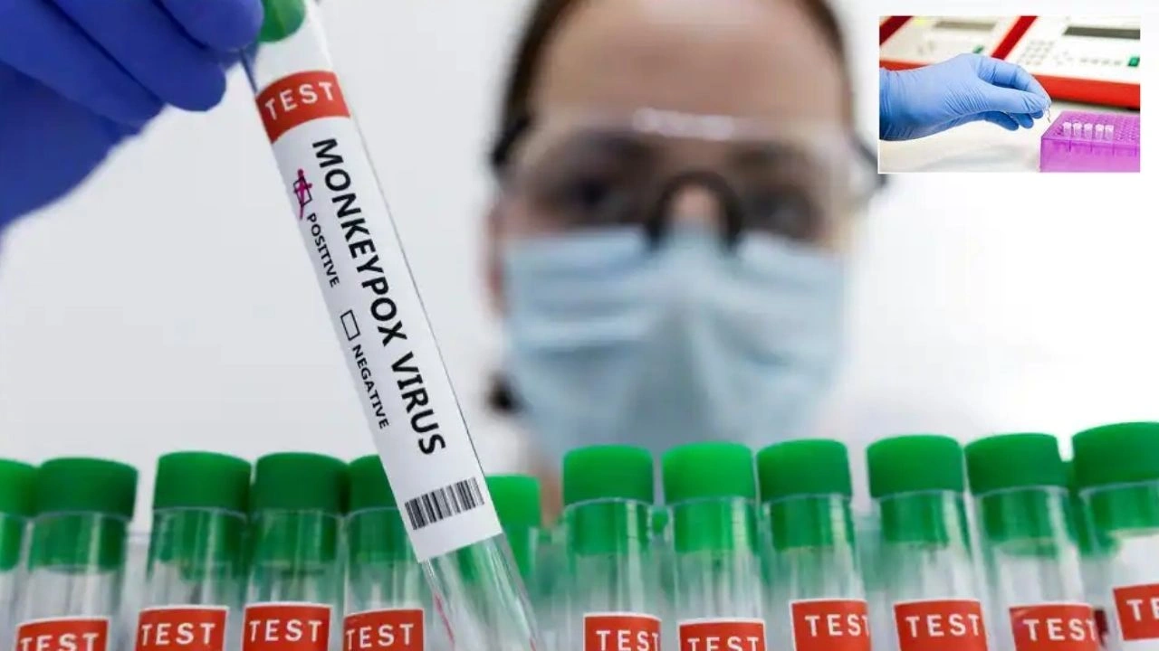 https://10tv.in/national/trivitron-healthcare-has-developed-a-real-time-pcr-kit-to-detect-monkeypox-435137.html