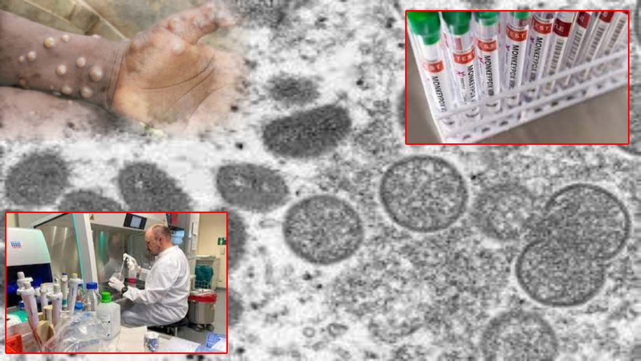 Monkeypox Virus : విజృంభిస్తున్న మంకీపాక్స్‌.. 14దేశాల్లో పాకిన వైరస్.. 100కిపైగా కేసులు..!