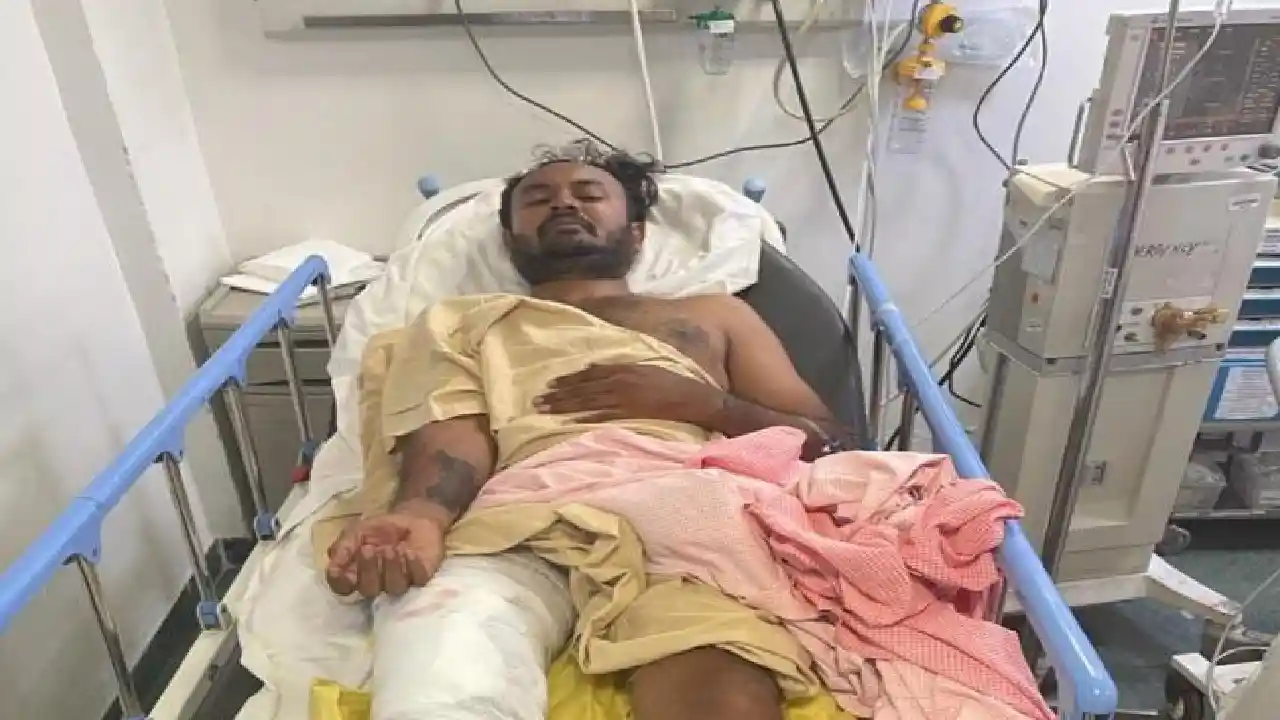https://10tv.in/crime/bengaluru-acid-attack-accused-tried-to-escape-was-shot-on-the-leg-by-police-426607.html