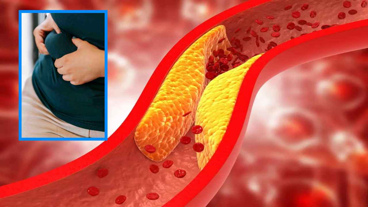 High Cholesterol : అధిక కొలెస్ట్రాల్ తో జాగ్రత్త!