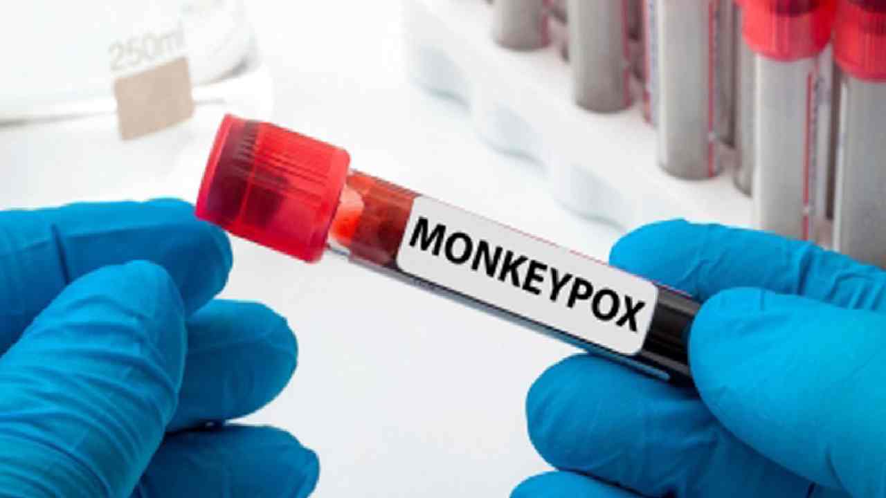 Monkeypox: మంకీపాక్స్ లక్షణాలతో కేరళవాసి మృతి