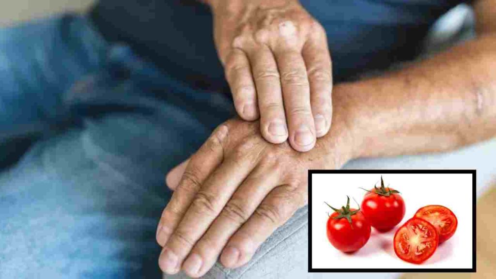 Tomatoes Bad For Arthritis