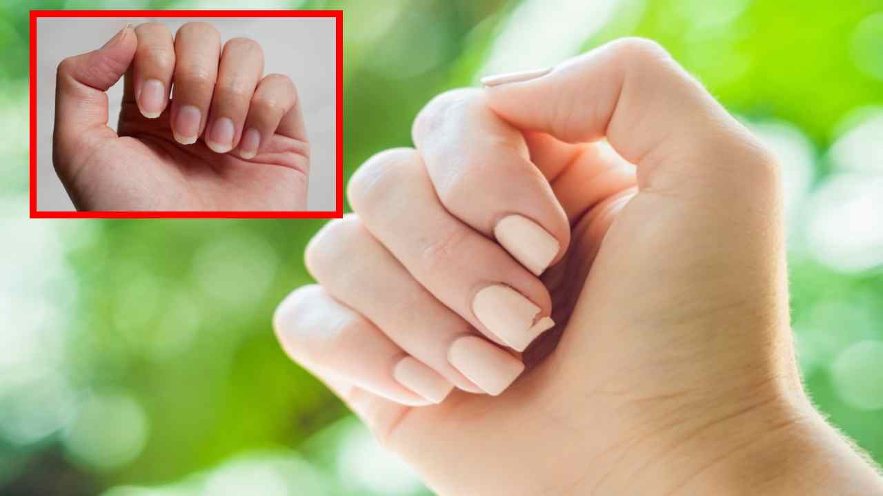 Brittle Nails గోళ్లు విరుగుతున్నాయా... జాగ్రత్త Are the nails