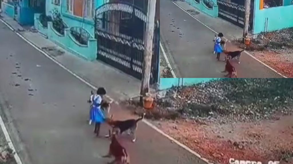 street dogs bit School girl